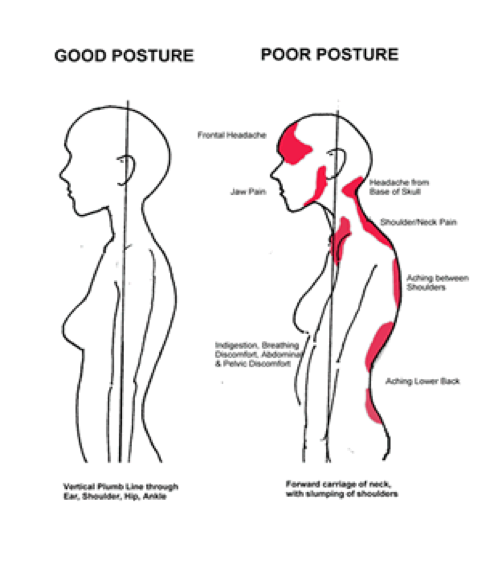Don't let poor posture affect your well-being. 😓💔 With the